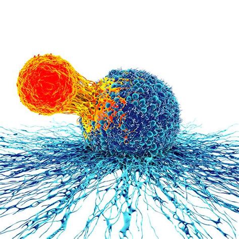 Asthma burden score reflecting patient experience may improve symptom ...