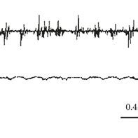 Typical Respiration And Genioglossus EMG Patterns After 130 Hz