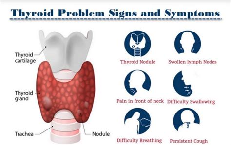 Thyroid Nodule Archives Dr Gaurav Gangwani