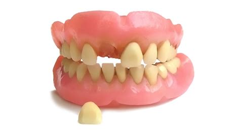 Denture Repair - Relines and Partials in Chicago at Affordable Prices