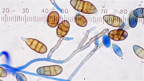 Airborne Mold Spores Youtube