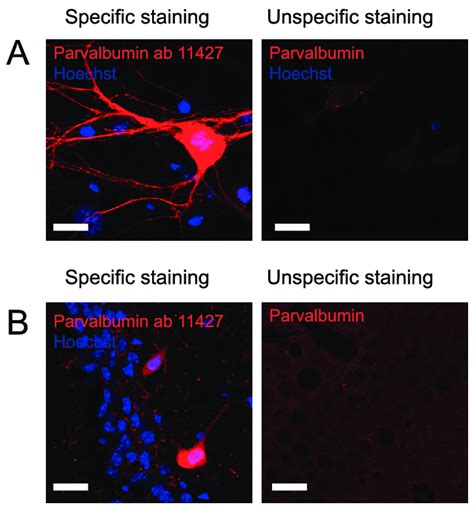 Staining Against Parvalbumin Interneurons Figure 1 Shows Download