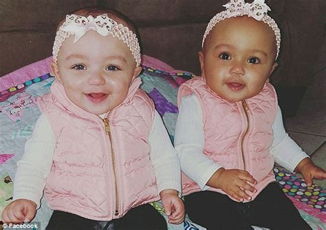 Rare Biracial Twins Born With Different Skin Colours Stay At Home Mum