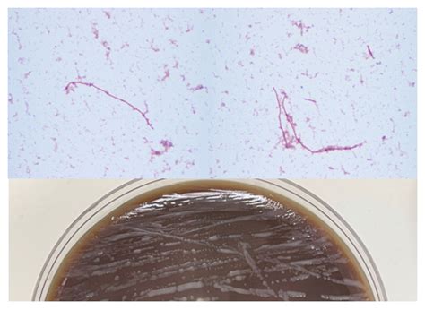 Microbiology Case Study: Bacteremia with Long, Gram Negative Rod in a ...