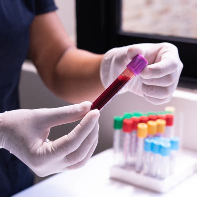 Blood Test Can Predict Presence Of Beta Amyloid In The Brain New Study