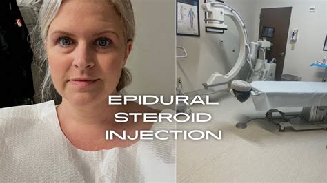 Epidural Steroid Injection My Experience Youtube