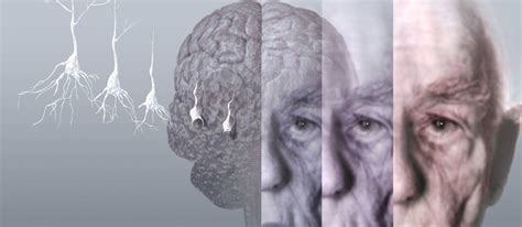 Cientistas Brasileiros Descobrem Como Prevenir Alzheimer Jornal O Globo