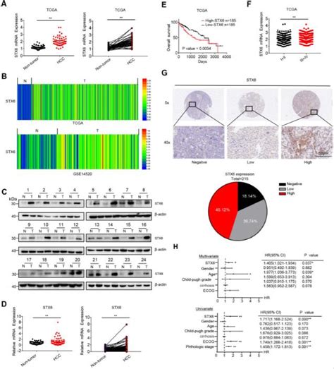 Synaxin Promotes The Progression Of Hepatocellular Carcinoma By