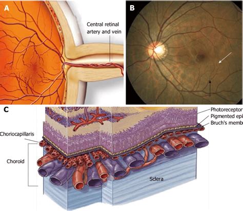 Central Retinal Artery