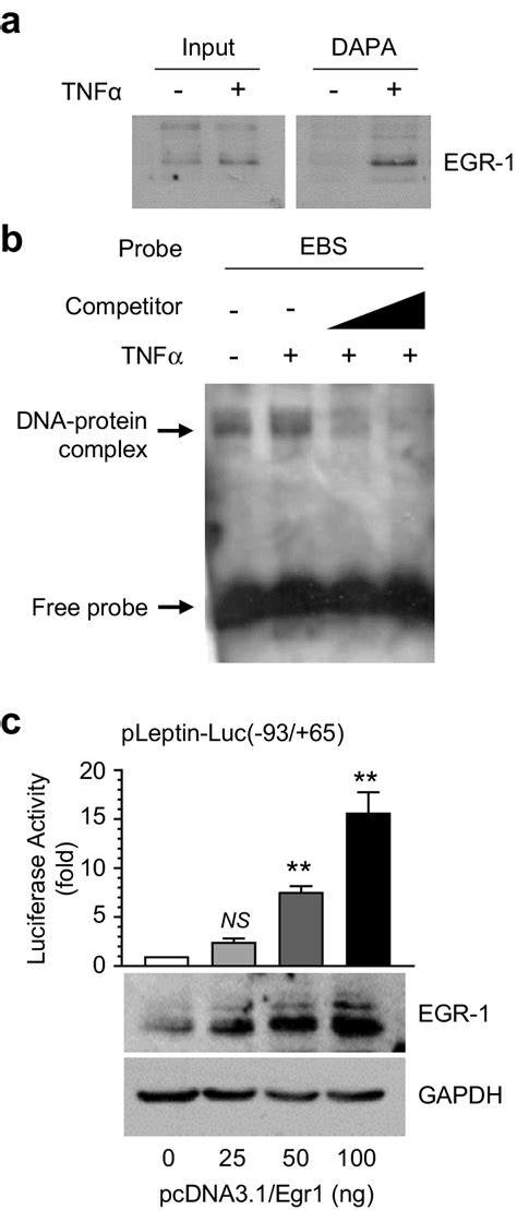 Effect of EGR1 silencing on TNF α induced leptin expression a MCF 7