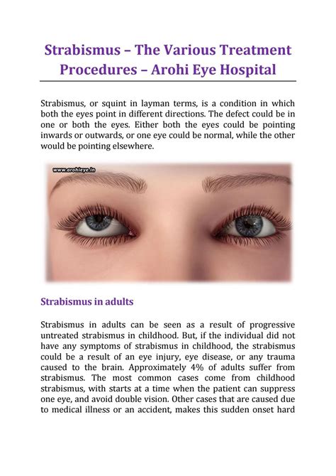 Strabismus The Various Treatment Procedures Arohi Eye Hospital By Arohieyehospital Issuu