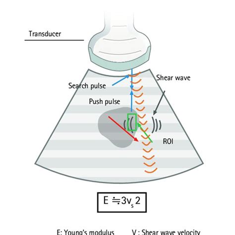 Principle Of Shear Wave Elastography To Generate A Shear Wave Download Scientific Diagram