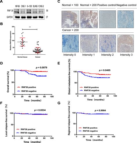 Rnf38 Expression In Nasopharyngeal Carcinoma 1 And Its Clinical Download Scientific Diagram