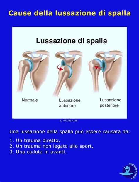 Lussazione Della Spalla I Sintomi Le Complicanze E Gli Esami Pi Utili