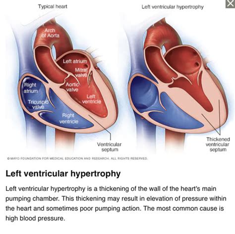 Cardio Vascular System Flashcards Quizlet