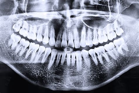 Optional Surichinmoi Nach außen ultraschallgeräte zahnmedizin Denken