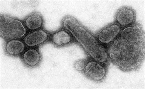 Electron Micrograph Of 1918 Influenza Virions Biology Of Human World