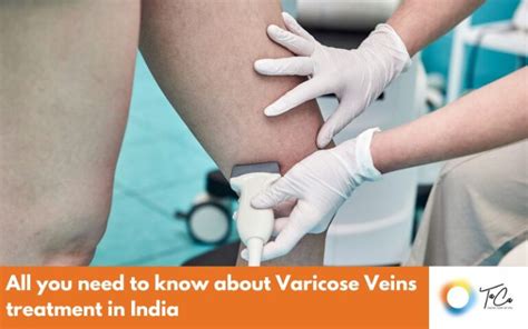 All You Need To Know About Varicose Veins Treatment In India Taca