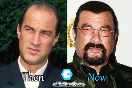 Steven Seagal Plastic Surgery, Hair Transplant, Before and After Pictures - CelebritiesWith.com