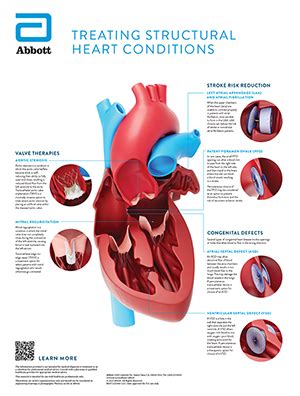 Structural Heart Disease Treatments Abbott