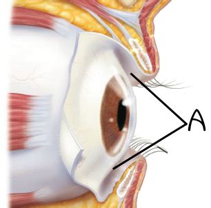 Anatomy Physiology II Lab Practical 1 Eyes Ears Flashcards Quizlet