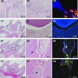 In Situ Hybridization For Dspp MRNA In The Pulp In The LiCl Group A