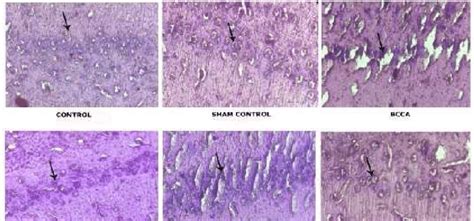 Photographic Representations Of Coronal Sections Of CA1 Region In