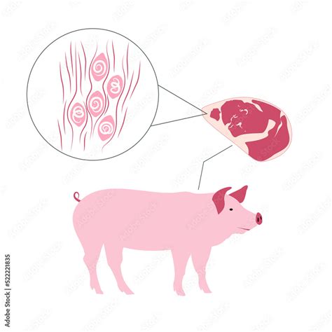 Infographic Of Pig And Sample Of Its Striated Muscle Tissue Under The