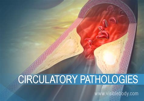 Circulatory Diseases And Disorders