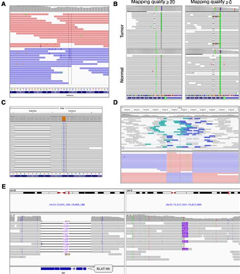 Figure 1 From Variant Review With The Integrative Genomics Viewer