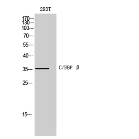 Anti Cebp Beta Antibody A95167