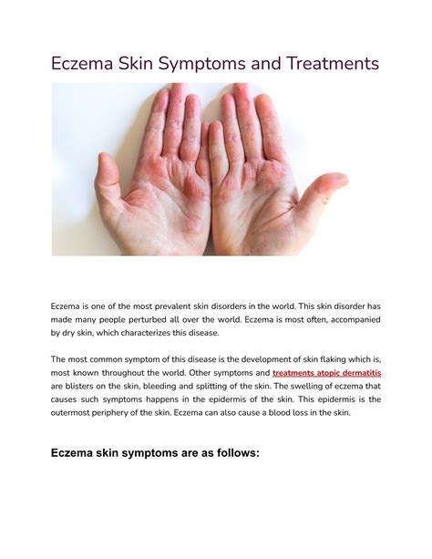 Eczema skin symptoms and Treatments by mahimaa - Issuu