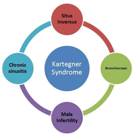 Kartagener syndrome | Radiology Reference Article | Radiopaedia.org ...