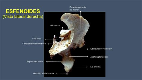 ANATOMIA HUMANA Del Hueso Esfenoides Pptx