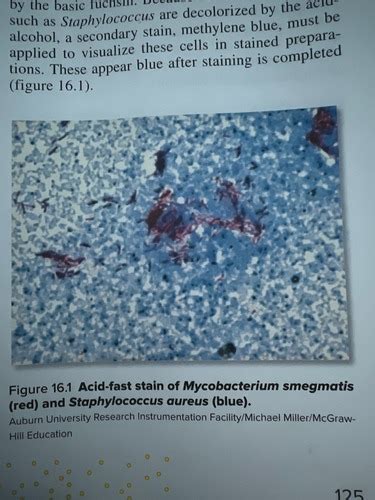 Acid Fast Staining Flashcards Quizlet