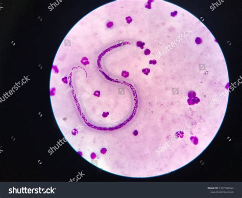 Wuchereria Bancrofti Microfilaria Stage Light Microscope Stock Photo ...