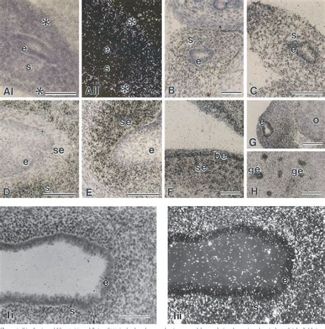 Table 1 From Developmental Changes Of The Oestrogen Receptor Alpha And