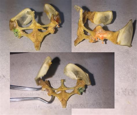 BIO22LAB 2 Frog Sternum Pectoral Girdle Diagram Quizlet