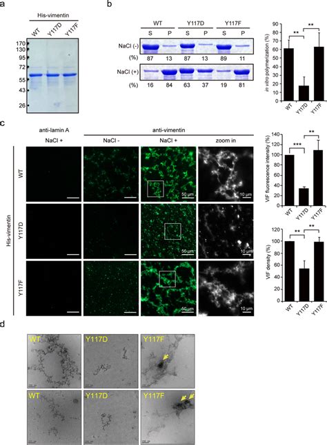 Substitution Of Vimentin Tyr With Asp Prevents Its Polymerization In