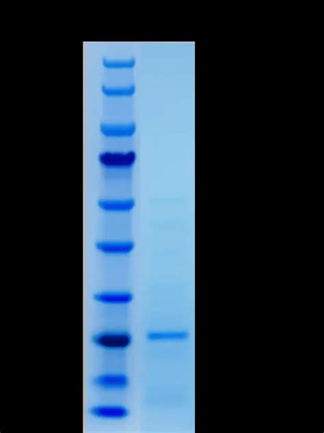 P01T0008 Human Tumor necrosis factor alpha TNF α Protein Recombinant