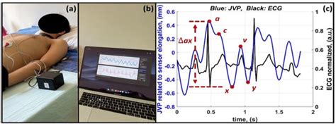 Diagnostics Free Full Text The Effect Of Submaximal Exercise On