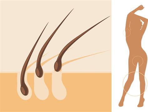 5 razlogov zakaj je ženskam bikini depilacija tako pomembna