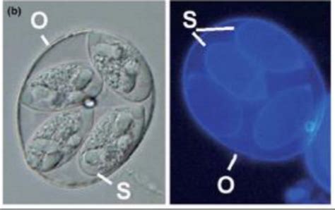 Parasito Toxoplasmosis Gondii Flashcards Quizlet