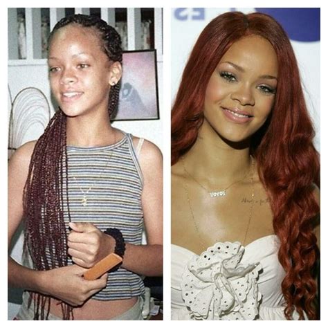 Rihanna Before And After Pinterest Rihanna