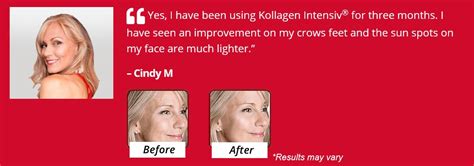 Best Kollagen Intensiv Before And After Pictures