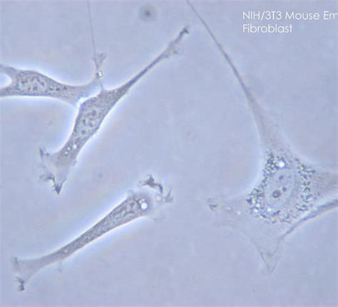 Difference Between Fibroblast And Fibrocyte Definition Features