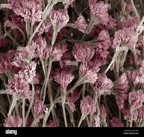 Penicillium Fungus Coloured Scanning Electron Micrograph Sem Of A