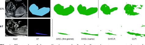 Figure 1 From Anatomy Aware Contrastive Representation Learning For Fetal Ultrasound Semantic