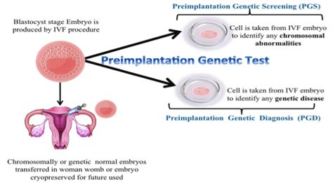 Pgs Pgd Treatment In Delhi And Delhi Ncr Zeeva Clinic