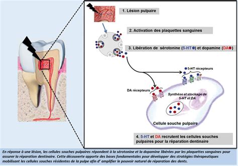 Le Pouvoir Naturel De R Paration Des Dents Lucid L Information Dentaire